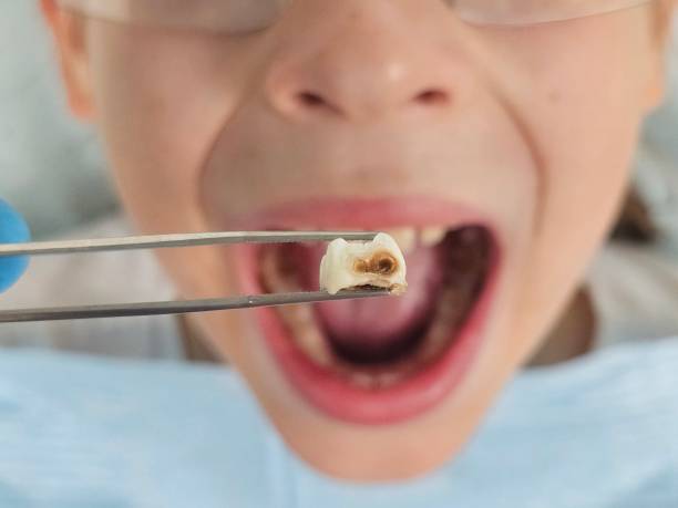 Best Knocked-Out Tooth Emergency  in South Rosemary, NC